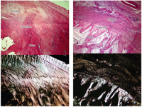 Microscopic images of tendon to bone transition